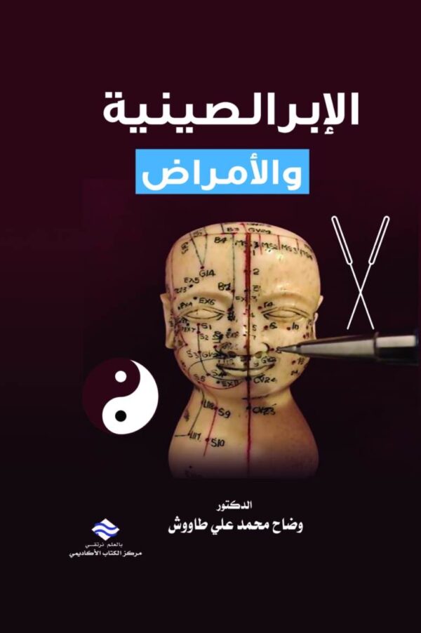 الإبر الصينية والأمراض